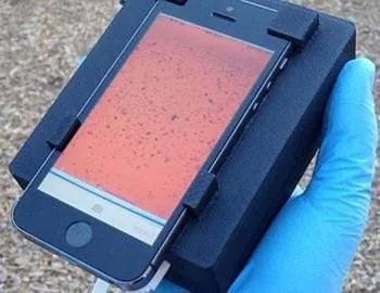 Un microscop dintr-un telefon mobil detectează paraziții din sânge