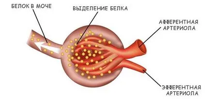 tratamentul