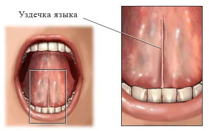 Tăierea frenulului limbii caracteristicile procedurii