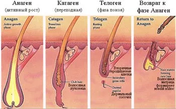 alopecie