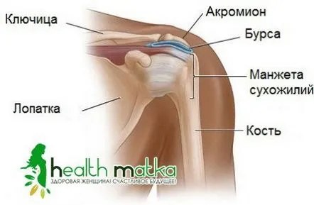 Bursita articulației umărului, manifestări clinice și tratament