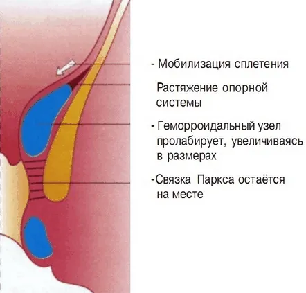 Patogeneza și cauzele hemoroizilor