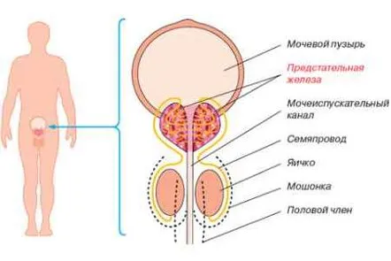 adenocarcinomului