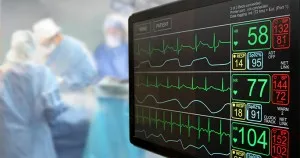 Ministerul rus al Apărării va produce stimulatoare cardiace cu trei camere