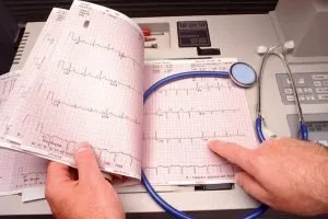 Tratamentul aritmiei cardiace cu medicamente și remedii populare