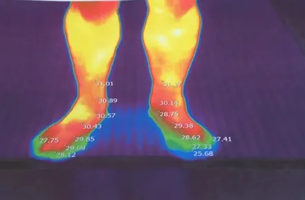 Diagnosticare folosind termografie