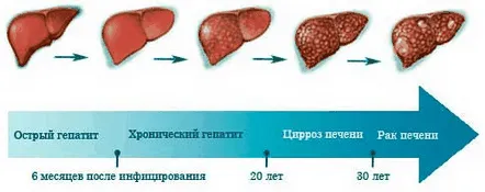 Cât timp se dezvoltă hepatita. Metode de combatere a utilizării vaccinurilor și a medicamentelor antivirale