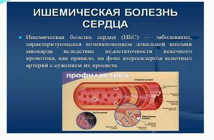 ischemia