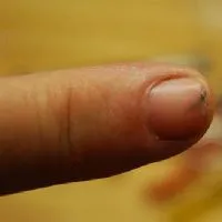 Cum de a scoate o așchie de la un copil Cum de a scoate o așchie de la un copil