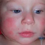 Care trateaza dermatolog Care trateaza dermatolog
