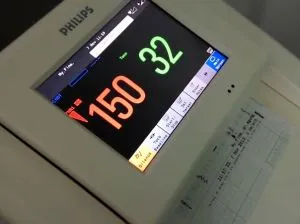 Cum să descifreze rezultatul CTG