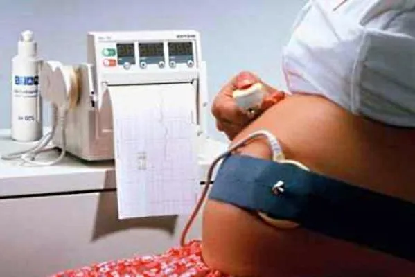Cum de a descifra rezultatele CTG Cum să descifreze rezultatul CTG
