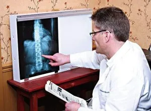 Cum am scăpat de hernie