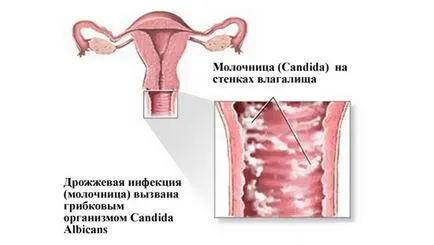 Sturz de la ceea ce se întâmplă