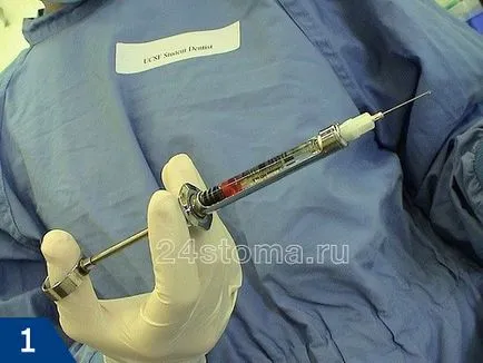 Ca procaina diluat