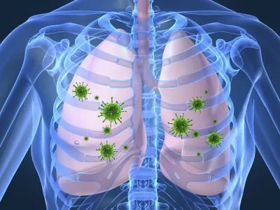 Forma închisă a tuberculozei, care este
