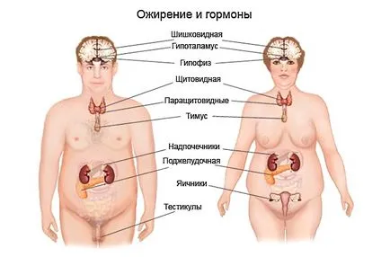 Obezitatea este un simptom Obezitatea este un simptom