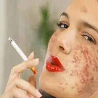 Ce se întâmplă dacă fata ta este fumat