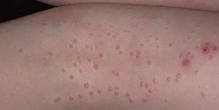 Copilul are o erupție care poate fi Copilul are o erupție care poate fi