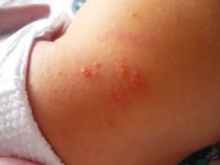 Copilul are o erupție care poate fi Copilul are o erupție care poate fi
