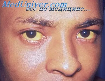 Hepatita cum să facă Hepatita cum să facă