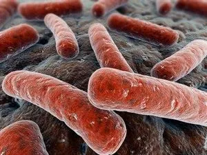 Forma închisă a tuberculozei, care este