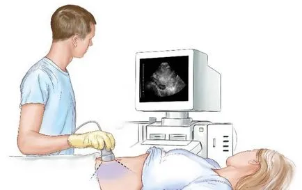 Uzi organele interne,