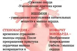 insuficiență coronariană cronică ce este