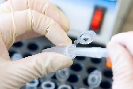 Analiza biopsii pentru care