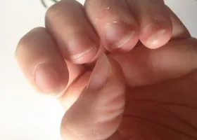 Biogel pentru întărirea unghiilor folosi, metode de aplicare și de îndepărtare