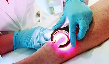 Durere cu varice - cum pentru a calma durerea în venele picioarelor, site-ul medical (durere) Durere cu varice - cum pentru a calma durerea în venele picioarelor, site-ul medical