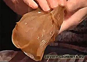 Kombucha miracol vindecător, ceea ce este unicitatea sa și i-au tratat
