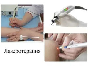 Cele mai bune pentru a elimina papiloame modalități mai bune (mai bună) Cele mai bune pentru a elimina papiloame modalități mai bune