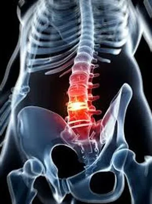 Ce este scleroza subcondral a suprafețelor articulare și plăcile de capăt ale corpurilor vertebrale