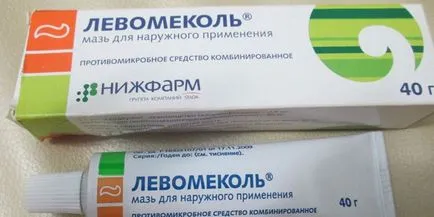 Dyshydrosis mâini - unguente tratament la domiciliu si dieta (perii) mâini Dyshydrosis - unguente tratament la domiciliu și dieta
