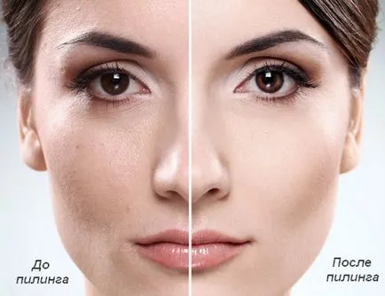 Enzyme peeling la domiciliu ceea ce este, etapele de (peeling) Enzyme peeling la domiciliu ceea ce este, etapele