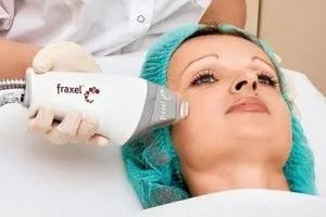 Fraxel - ce este, cum să treacă, reabilitarea, recenzii și fotografii (Fraxel) Fraxel - ce este, cum să treacă, reabilitarea, recenzii și fotografii