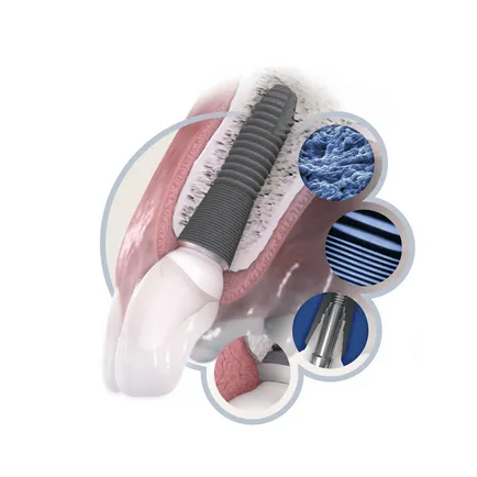 Implanturile dentare au rang mai bine clinici