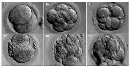 calitate Embryo, clasificarea, evaluarea pentru transferul eco
