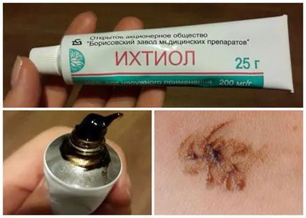 Ihtiolovaya unguent acnee - comentarii, pe fata, metoda de aplicare, ghid, ajutor, subcutanat (unguent) Ihtiolovaya unguent acnee - comentarii, pe fata, metoda de aplicare, ghid, ajutor, subcutanat