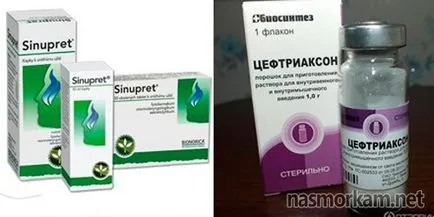 Cât de repede vindeca sinuzita la domiciliu