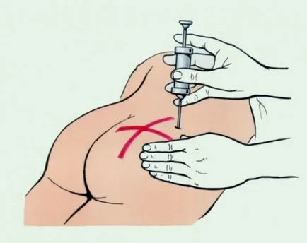 Cum sfaturi preparate injectabile pentru copii și trucuri (injecții) Cum sfaturi preparate injectabile pentru copii și trucuri