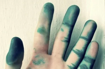Cum să se spele Zelenka de pe pielea mâinilor copilului, după varicela decât șterge rapid pata (varicela) Cum să se spele Zelenka de pe pielea mâinilor copilului, după varicela decât șterge rapid pata