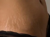 Cum de a elimina puncte negre pe nas tratamente eficiente (masca de puncte negre în casă) Cum de a elimina puncte negre pe nas tratamente eficiente