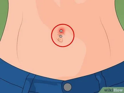 Cum să aibă grijă de un piercing buric