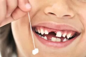 Cum de a smulge copilul dinte fara durere in casa copilului (ca smulge copilul dinte fara durere la domiciliu copilul elimina rapid painlessly corect filat) Cum de a smulge copilul dinte fara durere la domiciliu într-un copil