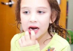 Cum de a smulge copilul dinte fara durere in casa copilului (ca smulge copilul dinte fara durere la domiciliu copilul elimina rapid painlessly corect filat) Cum de a smulge copilul dinte fara durere la domiciliu într-un copil