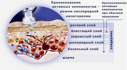 Cum de a alinia pielii după acnee și acnee tratament la domiciliu, tratamente de salon (tratamente) Cum de a alinia pielii după acnee și acnee tratament la domiciliu, tratament salon