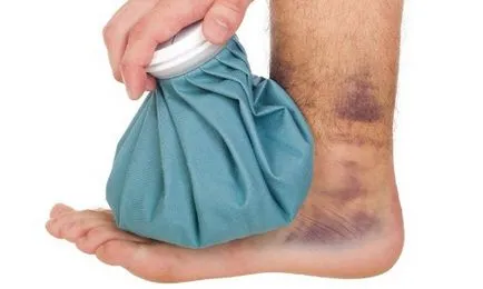 Comprimarea o vânătaie