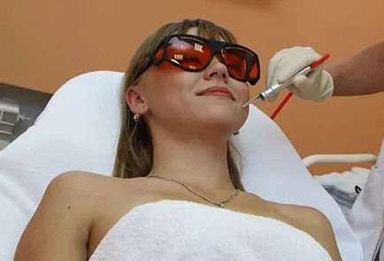 navele izbucni pe laser cauzele feței și îndepărtarea (feței) navele izbucni pe fata provoacă metode de îndepărtare și cu laser